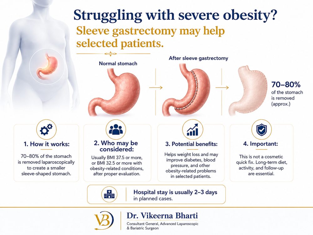 Bariatric Sleeve Gastrectomy patient education infographic
