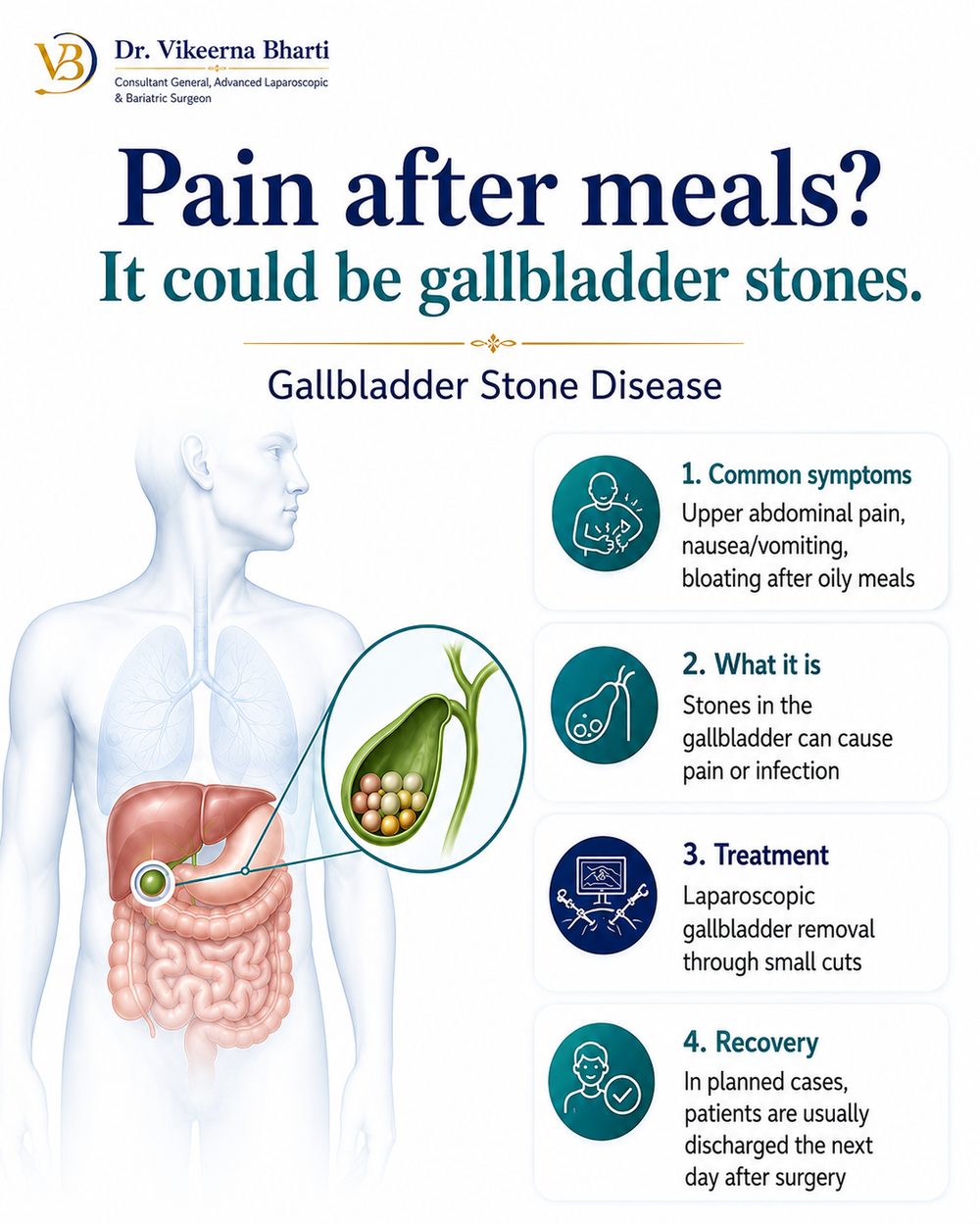 Gallbladder Stone Surgery in Ranchi patient education infographic
